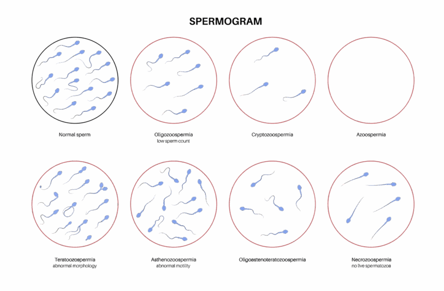 Abnormális- szuboptimális spermaképek