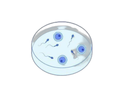 Megtermékenyítési módszerek – hagyományos IVF kezelés