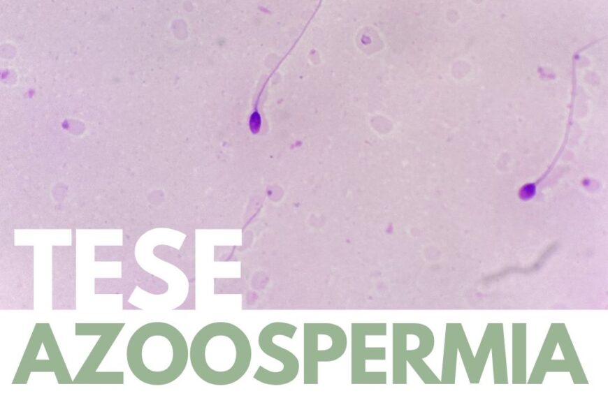 TESE, azoospermia