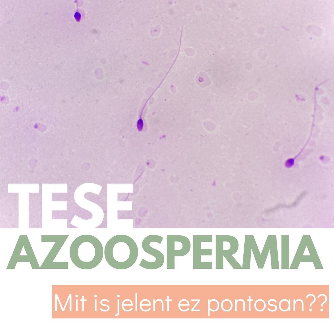 TESE, azoospermia